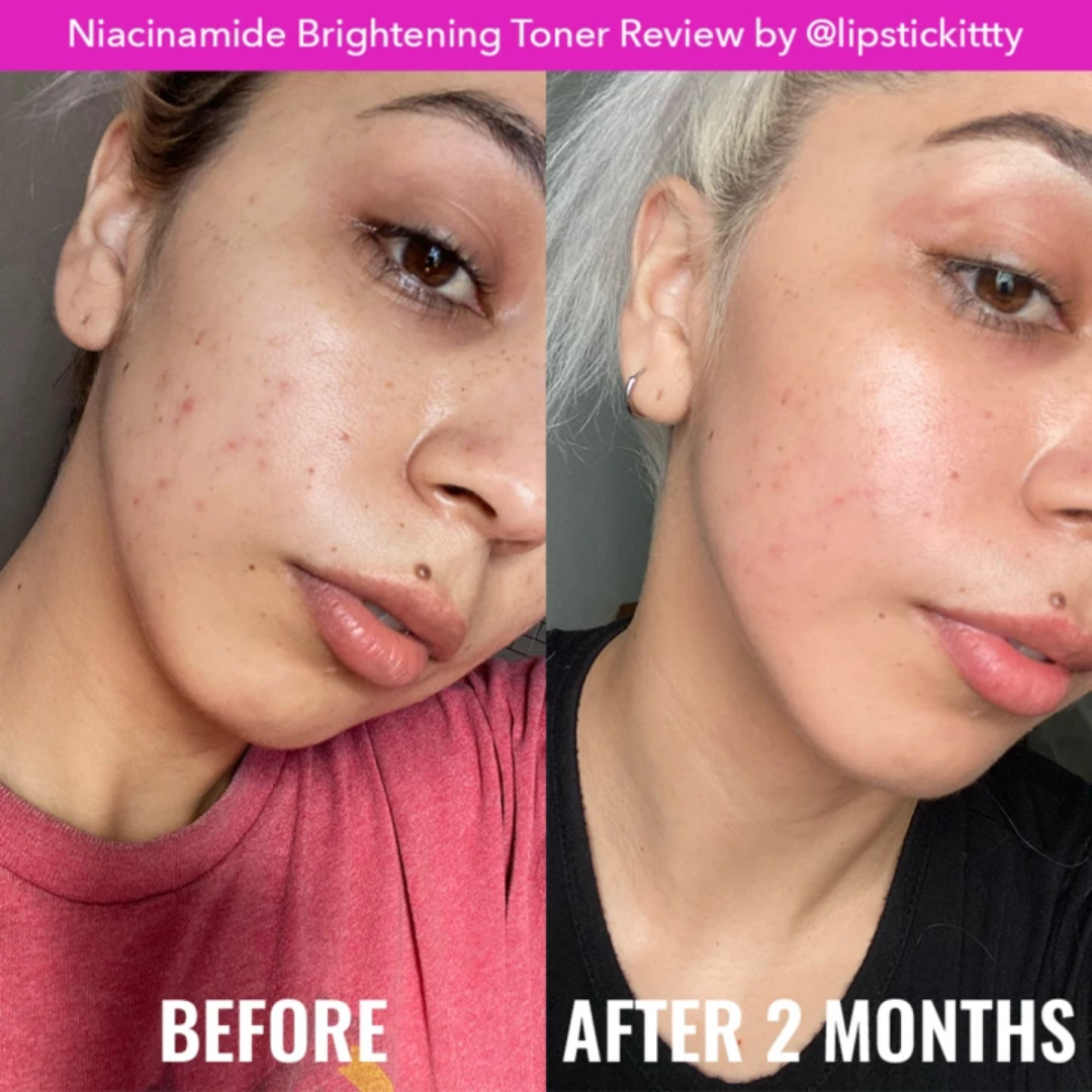 Niacinamide Brightening Toner - Good Molecules