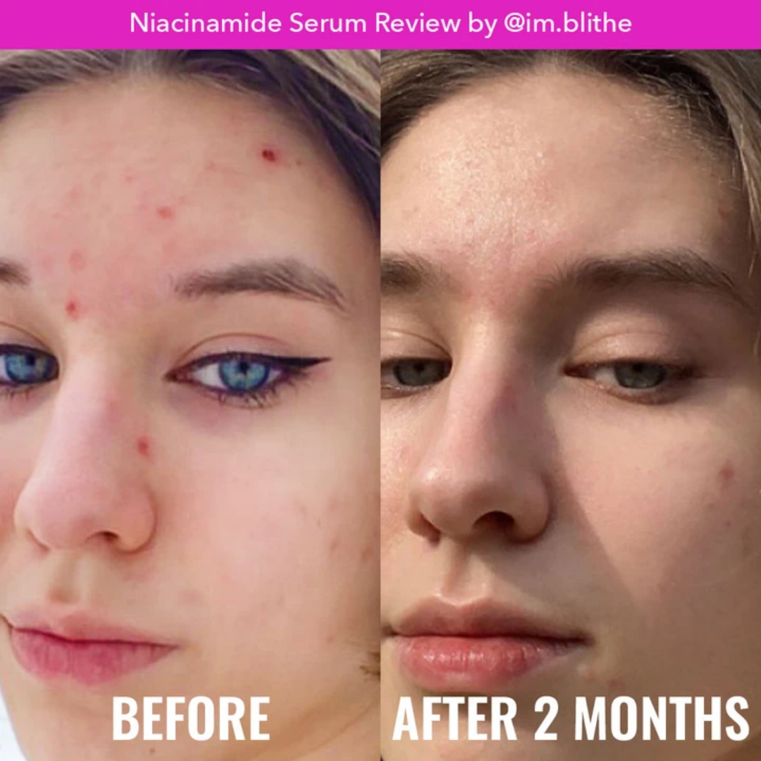 Niacinamide Serum - Good Molecules