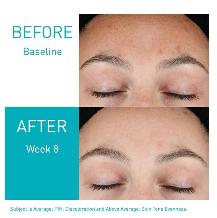 CERAVE - Resurfacing Retinol Serum